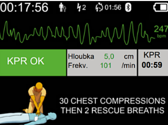 DefiSign Pocket Plus ECG Display Option - 11527